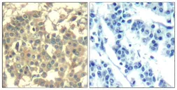 Anti-c-Met antibody used in IHC (Paraffin sections) (IHC-P). GTX50668