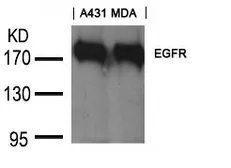 Anti-EGFR antibody used in Western Blot (WB). GTX50671