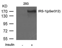 Anti-IRS1 (phospho Ser312) antibody used in Western Blot (WB). GTX50680