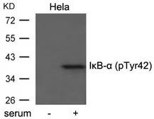 Anti-IKB alpha (phospho Tyr42) antibody used in Western Blot (WB). GTX50681