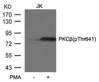 Anti-PKC beta 2 (phospho Thr641) antibody used in Western Blot (WB). GTX50682