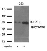 Anti-IGF1R (phospho Tyr1250) antibody used in Western Blot (WB). GTX50683