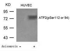 Anti-ATF2 (phospho Ser112) antibody used in Western Blot (WB). GTX50687