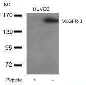 Anti-VEGF Receptor 3 antibody used in Western Blot (WB). GTX50694
