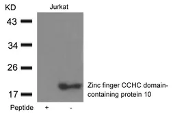 Anti-ZCCHC10 antibody used in Western Blot (WB). GTX50695
