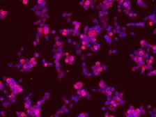 Anti-TrkB antibody used in Immunocytochemistry/ Immunofluorescence (ICC/IF). GTX50696