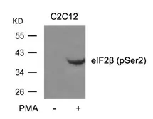 Anti-eIF2 beta (phospho Ser2) antibody used in Western Blot (WB). GTX50697