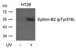 Anti-Ephrin B2 (phospho Tyr316) antibody used in Western Blot (WB). GTX50699
