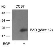 Anti-Bad (phospho Ser112) antibody used in Western Blot (WB). GTX50702