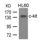 Anti-c-kit antibody used in Western Blot (WB). GTX50708