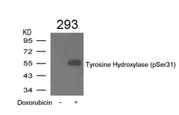 Anti-Tyrosine Hydroxylase (phospho Ser31) antibody used in Western Blot (WB). GTX50711