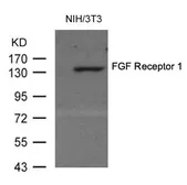 Anti-FGFR1 antibody used in Western Blot (WB). GTX50717