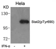 Anti-STAT2 (phospho Tyr690) antibody used in Western Blot (WB). GTX50721