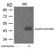 Anti-Cyclin E1 (phospho Thr395) antibody used in Western Blot (WB). GTX50722