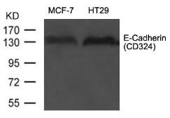 Anti-E-Cadherin antibody used in Western Blot (WB). GTX50757
