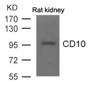 Anti-CD10 antibody used in Western Blot (WB). GTX50766