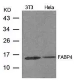 Anti-FABP4 antibody used in Western Blot (WB). GTX50771