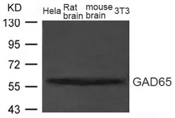 Anti-GAD65 antibody used in Western Blot (WB). GTX50783