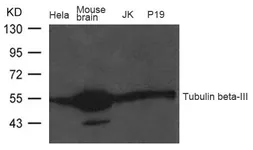 Anti-beta Tubulin 3/ Tuj1 antibody used in Western Blot (WB). GTX50789