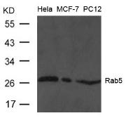Anti-Rab5 antibody used in Western Blot (WB). GTX50802