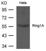 Anti-Ring1A antibody used in Western Blot (WB). GTX50803