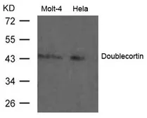 Anti-Doublecortin antibody used in Western Blot (WB). GTX50804