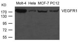 Anti-VEGF Receptor 1 antibody used in Western Blot (WB). GTX50805