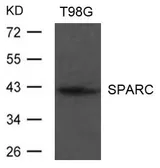 Anti-SPARC antibody used in Western Blot (WB). GTX50807