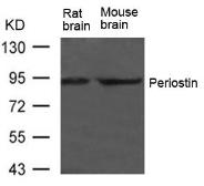 Anti-Periostin antibody used in Western Blot (WB). GTX50811