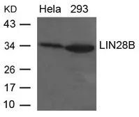 Anti-LIN28B antibody used in Western Blot (WB). GTX50820