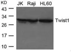 Anti-Twist1 antibody used in Western Blot (WB). GTX50821