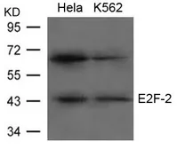 Anti-E2F2 antibody used in Western Blot (WB). GTX50837