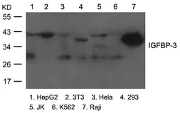 Anti-IGFBP3 antibody used in Western Blot (WB). GTX50853
