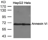 Anti-Annexin VI antibody used in Western Blot (WB). GTX50854