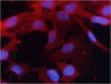 Anti-PKM2 antibody used in Immunocytochemistry/ Immunofluorescence (ICC/IF). GTX50857