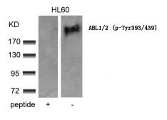 Anti-c-Abl (phospho Tyr412) antibody used in Western Blot (WB). GTX50859