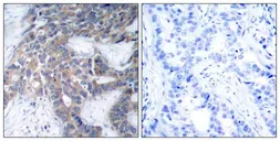 Anti-MEK1/MEK2 (phospho Ser218/Ser222) antibody used in IHC (Paraffin sections) (IHC-P). GTX50860