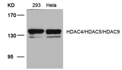 Anti-HDAC4/HDAC5/HDAC9 antibody used in Western Blot (WB). GTX50861