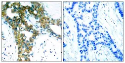 Anti-PAK1/PAK2/PAK3 antibody used in IHC (Paraffin sections) (IHC-P). GTX50865