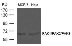 Anti-PAK1/PAK2/PAK3 antibody used in Western Blot (WB). GTX50865