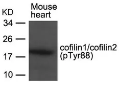 Anti-Cofilin (phospho Tyr89) antibody used in Western Blot (WB). GTX50866