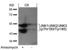 Anti-JNK (phospho Thr183/Tyr185) antibody used in Western Blot (WB). GTX50868