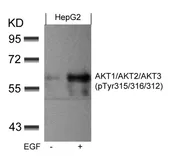 Anti-AKT (phospho Tyr315) antibody used in Western Blot (WB). GTX50869
