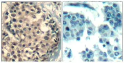Anti-HDAC4 (phospho Ser246) + HDAC5 (phospho Ser259) + HDAC9 (phospho Ser220) antibody used in IHC (Paraffin sections) (IHC-P). GTX50871