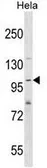 Anti-SH3PXD2A antibody, N-term used in Western Blot (WB). GTX50879