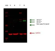 Anti-Glutaminase (KGA) antibody, C-term used in Western Blot (WB). GTX50891
