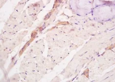 Anti-Tenascin C antibody used in IHC (Paraffin sections) (IHC-P). GTX50895