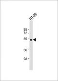 Anti-Hepatic lipase antibody used in Western Blot (WB). GTX50912