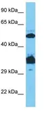 Anti-Sp7 antibody, C-term used in Western Blot (WB). GTX50962