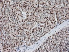 Anti-MCTS1 antibody [2G2] used in IHC (Paraffin sections) (IHC-P). GTX50967